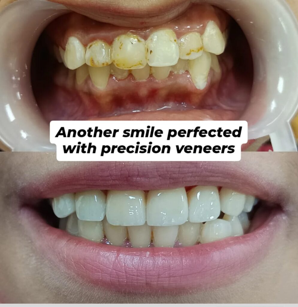 Cosmetic Dentistry